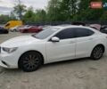 Білий Акура ТЛХ, об'ємом двигуна 2.4 л та пробігом 92 тис. км за 2700 $, фото 1 на Automoto.ua