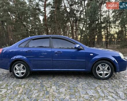 Синий Шевроле Лачетти, объемом двигателя 1.8 л и пробегом 187 тыс. км за 4000 $, фото 2 на Automoto.ua