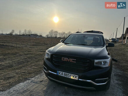 ДжиЭмСи Акадия 2018 в Броварах на Automoto.ua Черный ДжиЭмСи Акадия, объемом двигателя 3.56 л и пробегом 190 тыс. км за 22500 $, фото 1 на Automoto.ua