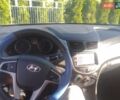 Хендай Акцент 2018 в Надворной на Automoto.ua Белый Хендай Акцент, объемом двигателя 1.58 л и пробегом 79 тыс. км за 11800 $, фото 1 на Automoto.ua