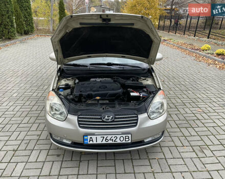 Хендай Акцент 2008 в Прилуках на Automoto.ua Бежевый Хендай Акцент, объемом двигателя 1.4 л и пробегом 226 тыс. км за 4450 $, фото 25 на Automoto.ua