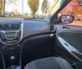 Хендай Акцент 2011 у Києві на Automoto.ua Чорний Хендай Акцент, об'ємом двигуна 1.6 л та пробігом 114 тис. км за 7999 $, фото 10 на Automoto.ua