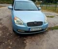 Сірий Хендай Акцент, об'ємом двигуна 1.4 л та пробігом 225 тис. км за 4800 $, фото 1 на Automoto.ua