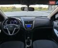 Хендай Акцент 2013 у Києві на Automoto.ua Сірий Хендай Акцент, об'ємом двигуна 1.4 л та пробігом 105 тис. км за 7999 $, фото 22 на Automoto.ua