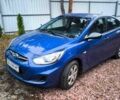 Хендай Акцент 2013 в Киеве на Automoto.ua Синий Хендай Акцент, объемом двигателя 1.4 л и пробегом 65 тыс. км за 7200 $, фото 1 на Automoto.ua