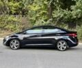 Чорний Хендай Елантра, об'ємом двигуна 1.8 л та пробігом 71 тис. км за 5500 $, фото 3 на Automoto.ua