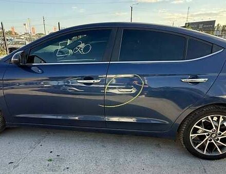 Синій Хендай Елантра, об'ємом двигуна 2 л та пробігом 160 тис. км за 8500 $, фото 3 на Automoto.ua