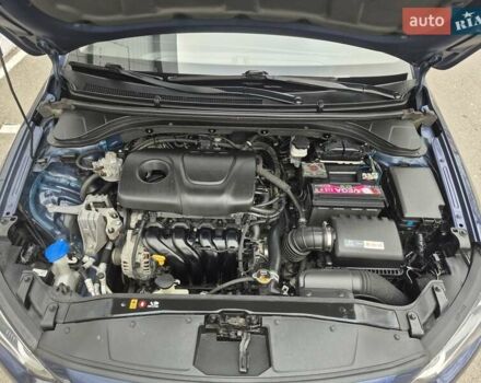 Синій Хендай Елантра, об'ємом двигуна 1.6 л та пробігом 119 тис. км за 13350 $, фото 64 на Automoto.ua