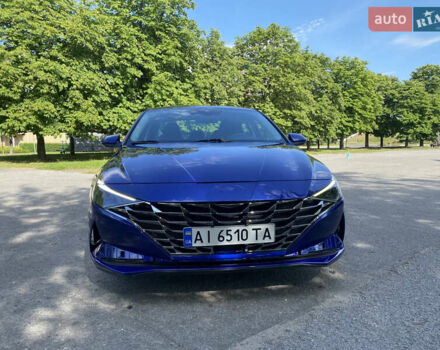 Синий Хендай Элантра, объемом двигателя 1.98 л и пробегом 79 тыс. км за 17999 $, фото 6 на Automoto.ua