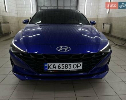 Хендай Элантра 2021 в Сумах на Automoto.ua Синий Хендай Элантра, объемом двигателя 1.58 л и пробегом 136 тыс. км за 17999 $, фото 5 на Automoto.ua