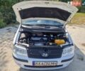 Белый Хендай Матрикс, объемом двигателя 1.6 л и пробегом 280 тыс. км за 4300 $, фото 17 на Automoto.ua
