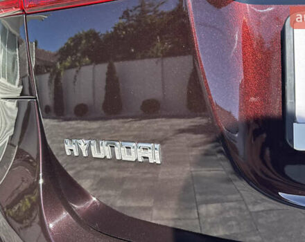 Хендай Санта Фе 2011 в Ивано-Франковске на Automoto.ua Коричневый Хендай Санта Фе, объемом двигателя 2.2 л и пробегом 186 тыс. км за 14950 $, фото 31 на Automoto.ua