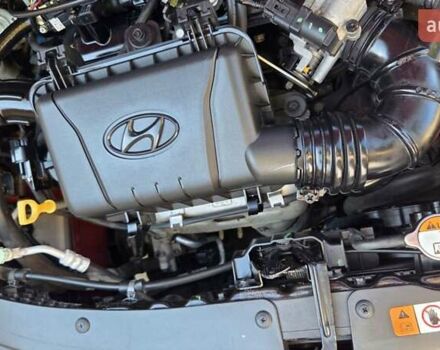 Красный Хендай и10, объемом двигателя 1.2 л и пробегом 48 тыс. км за 9000 $, фото 43 на Automoto.ua