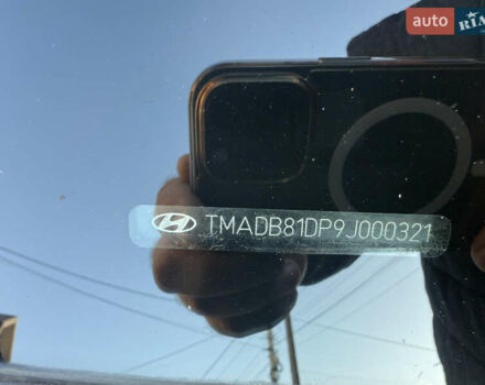 Хендай i30 2009 в Борисполе на Automoto.ua Черный Хендай i30, объемом двигателя 1.6 л и пробегом 229 тыс. км за 7000 $, фото 60 на Automoto.ua