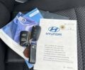 Хендай i30 2010 в Смеле на Automoto.ua Черный Хендай i30, объемом двигателя 1.58 л и пробегом 229 тыс. км за 6900 $, фото 9 на Automoto.ua
