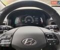 Белый Хендай Ioniq, объемом двигателя 0 л и пробегом 118 тыс. км за 11850 $, фото 60 на Automoto.ua