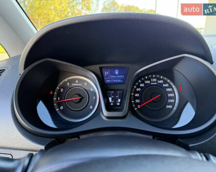 Черный Хендай ix20, объемом двигателя 1.6 л и пробегом 176 тыс. км за 10500 $, фото 13 на Automoto.ua