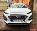 Білий Хендай Kona, об'ємом двигуна 2 л та пробігом 60 тис. км за 16000 $, фото 1 на Automoto.ua