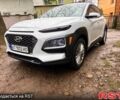 Білий Хендай Kona, об'ємом двигуна 2 л та пробігом 60 тис. км за 16000 $, фото 3 на Automoto.ua