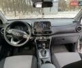 Білий Хендай Kona, об'ємом двигуна 2 л та пробігом 86 тис. км за 14500 $, фото 2 на Automoto.ua