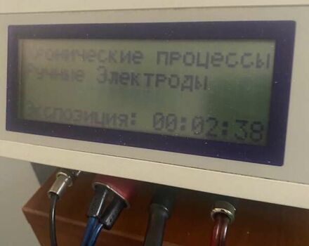 Білий Хендай Kona, об'ємом двигуна 0 л та пробігом 113 тис. км за 18300 $, фото 60 на Automoto.ua
