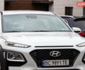 Белый Хендай Kona, объемом двигателя 2 л и пробегом 98 тыс. км за 15200 $, фото 3 на Automoto.ua