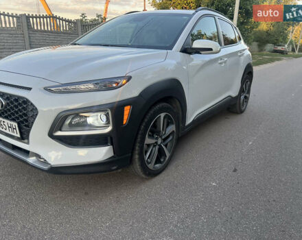 Білий Хендай Kona, об'ємом двигуна 1.59 л та пробігом 22 тис. км за 18500 $, фото 1 на Automoto.ua