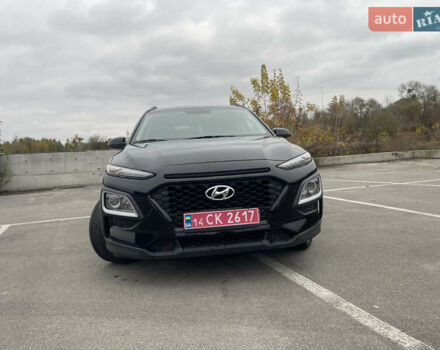 Хендай Kona 2018 в Буче на Automoto.ua Черный Хендай Kona, объемом двигателя 2 л и пробегом 150 тыс. км за 15000 $, фото 14 на Automoto.ua