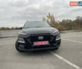 Хендай Kona 2018 в Буче на Automoto.ua Черный Хендай Kona, объемом двигателя 2 л и пробегом 150 тыс. км за 15000 $, фото 14 на Automoto.ua