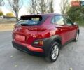 Красный Хендай Kona, объемом двигателя 2 л и пробегом 179 тыс. км за 13500 $, фото 3 на Automoto.ua