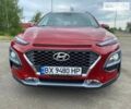 Красный Хендай Kona, объемом двигателя 1.59 л и пробегом 62 тыс. км за 17800 $, фото 3 на Automoto.ua