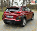 Красный Хендай Kona, объемом двигателя 2 л и пробегом 106 тыс. км за 14300 $, фото 3 на Automoto.ua