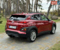 Красный Хендай Kona, объемом двигателя 2 л и пробегом 106 тыс. км за 14300 $, фото 9 на Automoto.ua