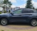 Хендай Kona, об'ємом двигуна 2 л та пробігом 66 тис. км за 18890 $, фото 5 на Automoto.ua
