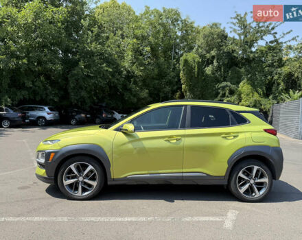 Хендай Kona, объемом двигателя 1.6 л и пробегом 50 тыс. км за 16999 $, фото 2 на Automoto.ua