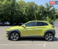 Хендай Kona, объемом двигателя 1.6 л и пробегом 50 тыс. км за 16999 $, фото 2 на Automoto.ua
