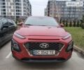 Хендай Kona, объемом двигателя 2 л и пробегом 76 тыс. км за 16800 $, фото 15 на Automoto.ua