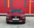 Хендай Kona, об'ємом двигуна 2 л та пробігом 136 тис. км за 15990 $, фото 2 на Automoto.ua