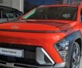 купити нове авто Хендай Kona 2024 року від офіційного дилера Автоберег HYUNDAI на Бальзака Хендай фото