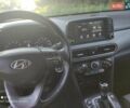 Серый Хендай Kona, объемом двигателя 2 л и пробегом 86 тыс. км за 15500 $, фото 15 на Automoto.ua
