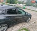 Серый Хендай Kona, объемом двигателя 2 л и пробегом 86 тыс. км за 15500 $, фото 5 на Automoto.ua