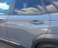Серый Хендай Kona, объемом двигателя 0 л и пробегом 115 тыс. км за 17300 $, фото 1 на Automoto.ua
