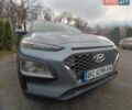 Сірий Хендай Kona, об'ємом двигуна 2 л та пробігом 112 тис. км за 14200 $, фото 3 на Automoto.ua