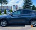 Серый Хендай Kona, объемом двигателя 2 л и пробегом 51 тыс. км за 17300 $, фото 3 на Automoto.ua