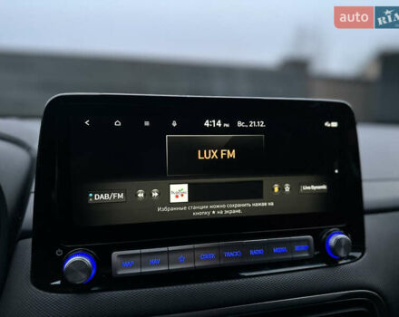 Сірий Хендай Kona, об'ємом двигуна 0 л та пробігом 57 тис. км за 17700 $, фото 32 на Automoto.ua