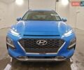 Синій Хендай Kona, об'ємом двигуна 1.59 л та пробігом 137 тис. км за 2600 $, фото 4 на Automoto.ua
