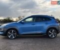 Синий Хендай Kona, объемом двигателя 1.6 л и пробегом 53 тыс. км за 15500 $, фото 3 на Automoto.ua