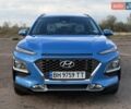 Синий Хендай Kona, объемом двигателя 1.6 л и пробегом 53 тыс. км за 15500 $, фото 2 на Automoto.ua
