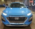 Синий Хендай Kona, объемом двигателя 0 л и пробегом 83 тыс. км за 2600 $, фото 4 на Automoto.ua