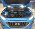 Синий Хендай Kona, объемом двигателя 0 л и пробегом 83 тыс. км за 2600 $, фото 11 на Automoto.ua